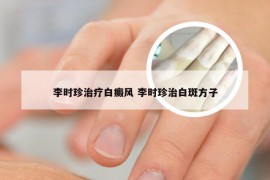 李时珍治疗白癜风 李时珍治白斑方子