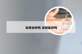 白斑会好吗 白斑能好吗