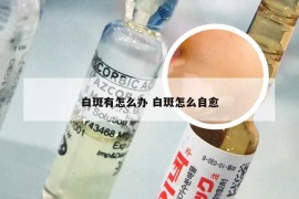 白斑有怎么办 白斑怎么自愈