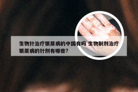 生物针治疗银屑病的中国有吗 生物制剂治疗银屑病的针剂有哪些?