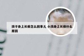 孩子身上长癣怎么回事儿 小孩身上长癣什么原因