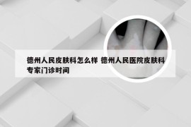 德州人民皮肤科怎么样 德州人民医院皮肤科专家门诊时间