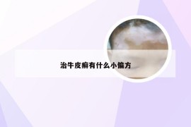 治牛皮癣有什么小偏方