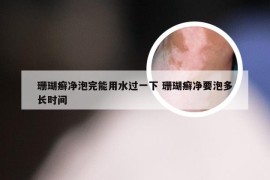 珊瑚癣净泡完能用水过一下 珊瑚癣净要泡多长时间