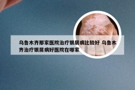 乌鲁木齐那家医院治疗银屑病比较好 乌鲁木齐治疗银屑病好医院在哪家