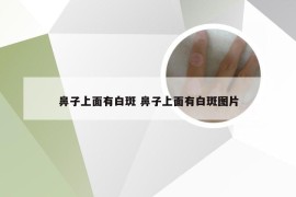 鼻子上面有白斑 鼻子上面有白斑图片