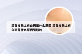 后背皮肤上有白斑是什么原因 后背皮肤上有白斑是什么原因引起的