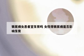 银屑病女患者宜生育吗 女性得银屑病是否影响生育