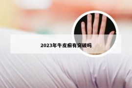 2023年牛皮癣有突破吗