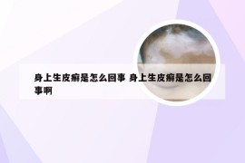 身上生皮癣是怎么回事 身上生皮癣是怎么回事啊