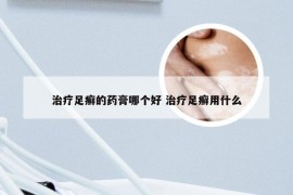 治疗足癣的药膏哪个好 治疗足癣用什么