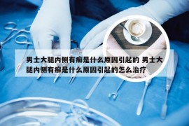 男士大腿内侧有癣是什么原因引起的 男士大腿内侧有癣是什么原因引起的怎么治疗