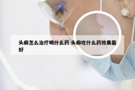 头癣怎么治疗喝什么药 头癣吃什么药效果最好