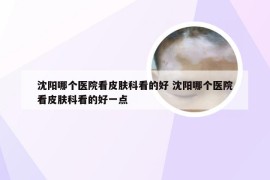 沈阳哪个医院看皮肤科看的好 沈阳哪个医院看皮肤科看的好一点