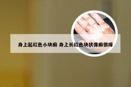 身上起红色小块癣 身上长红色块状像癣很痒