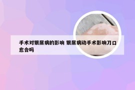 手术对银屑病的影响 银屑病动手术影响刀口愈合吗