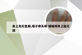 身上出红色癣,嗓子疼头疼 喉咙疼身上起红斑