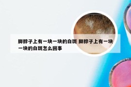 脚脖子上有一块一块的白斑 脚脖子上有一块一块的白斑怎么回事