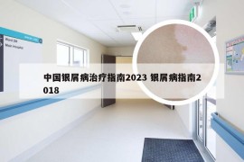 中国银屑病治疗指南2023 银屑病指南2018