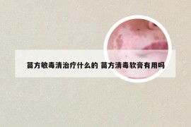 苗方敏毒清治疗什么的 苗方清毒软膏有用吗