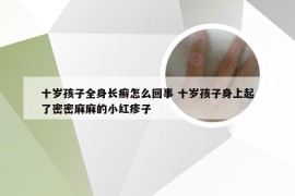 十岁孩子全身长癣怎么回事 十岁孩子身上起了密密麻麻的小红疹子