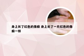 身上长了红色的像癣 身上长了一片红色的像癣一样