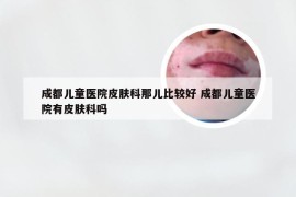 成都儿童医院皮肤科那儿比较好 成都儿童医院有皮肤科吗