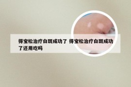 得宝松治疗白斑成功了 得宝松治疗白斑成功了还用吃吗