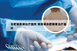 合肥银屑病治疗医院 银屑病合肥哪里治疗最好