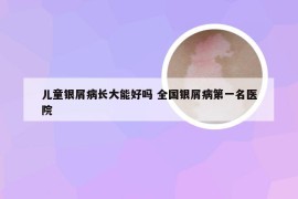 儿童银屑病长大能好吗 全国银屑病第一名医院