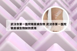 武汉市第一医院银屑病生物 武汉市第一医院银屑病生物制剂费用