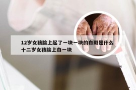 12岁女孩脸上起了一块一块的白斑是什么 十二岁女孩脸上白一块