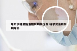 哈尔滨哪里能治银屑病的医院 哈尔滨治银屑病专科