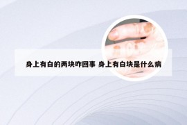 身上有白的两块咋回事 身上有白块是什么病