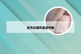 后天白癜风是遗传嘛