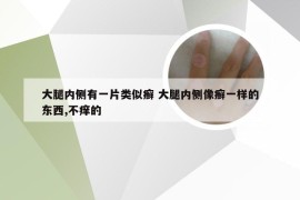 大腿内侧有一片类似癣 大腿内侧像癣一样的东西,不痒的