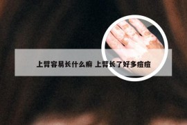 上臂容易长什么癣 上臂长了好多痘痘