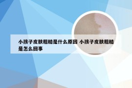 小孩子皮肤粗糙是什么原因 小孩子皮肤粗糙是怎么回事