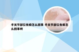 手关节部位有癣怎么回事 手关节部位有癣怎么回事啊