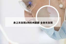 身上长白斑a询杭州丽都 全身长白斑