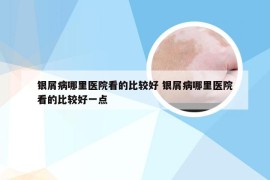 银屑病哪里医院看的比较好 银屑病哪里医院看的比较好一点