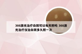 308激光治疗白斑可以每天照吗 308激光治疗仪治白斑多久照一次