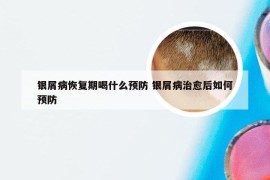 银屑病恢复期喝什么预防 银屑病治愈后如何预防