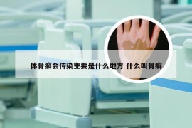 体骨癣会传染主要是什么地方 什么叫骨癣