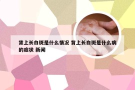 背上长白斑是什么情况 背上长白斑是什么病的症状 新闻