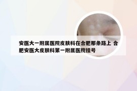 安医大一附属医院皮肤科在合肥那条路上 合肥安医大皮肤科第一附属医院挂号