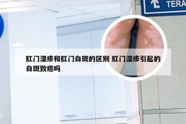 肛门湿疹和肛门白斑的区别 肛门湿疹引起的白斑致癌吗