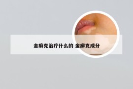 金癣克治疗什么的 金癣克成分