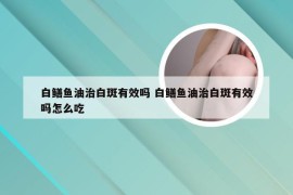 白鳝鱼油治白斑有效吗 白鳝鱼油治白斑有效吗怎么吃