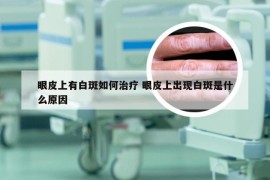 眼皮上有白斑如何治疗 眼皮上出现白斑是什么原因